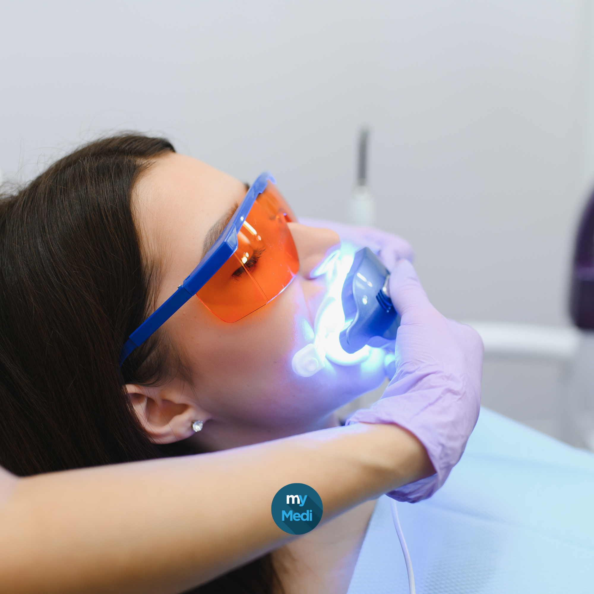 Accessoires pour blanchiment