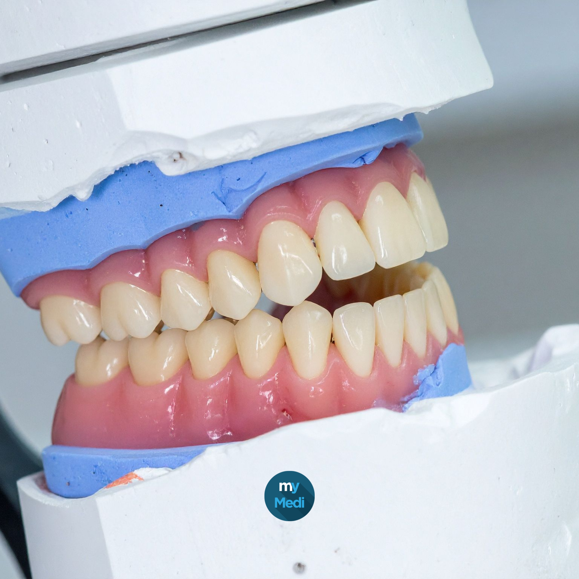 Laboratoire / prothèse