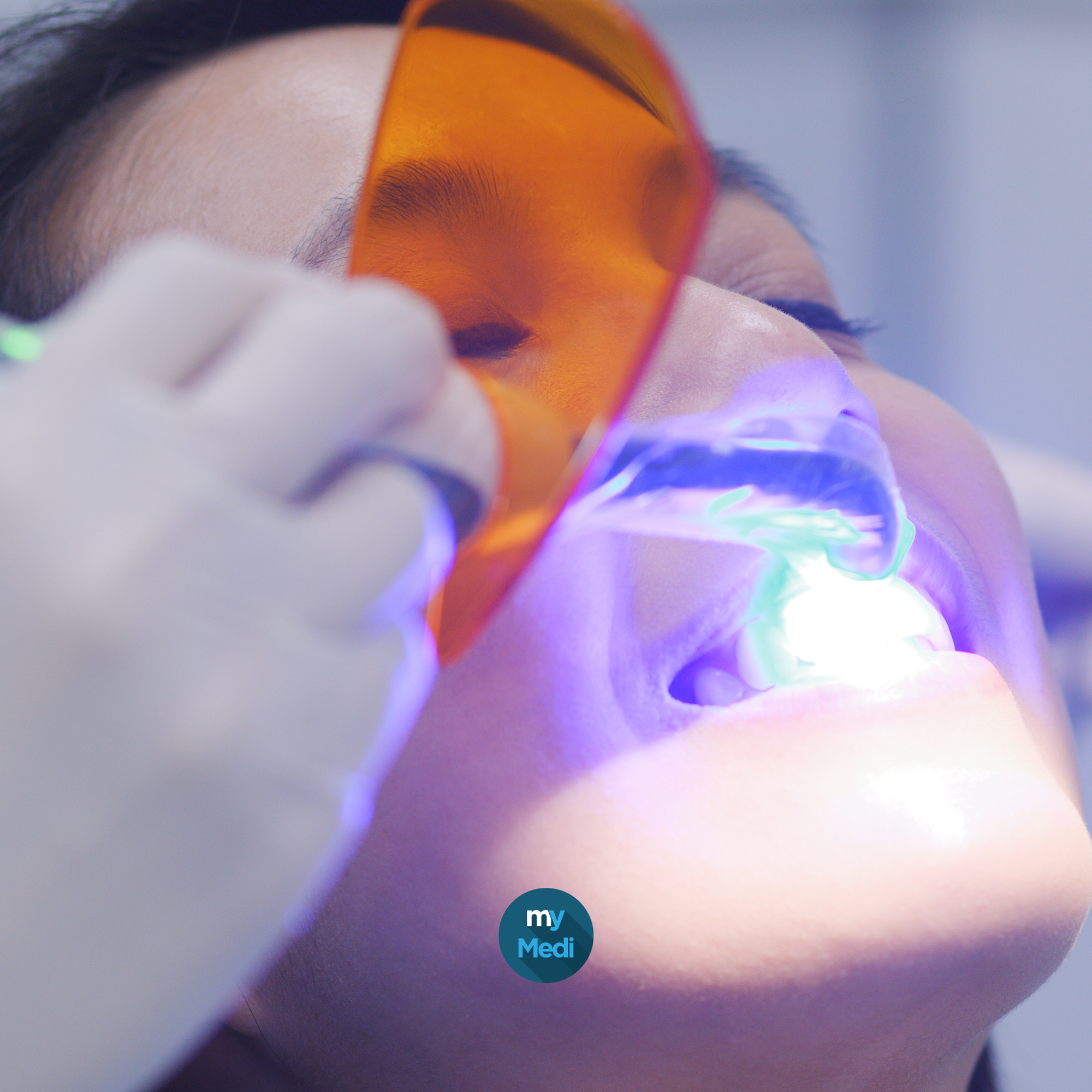 Lampe à photopolymériser