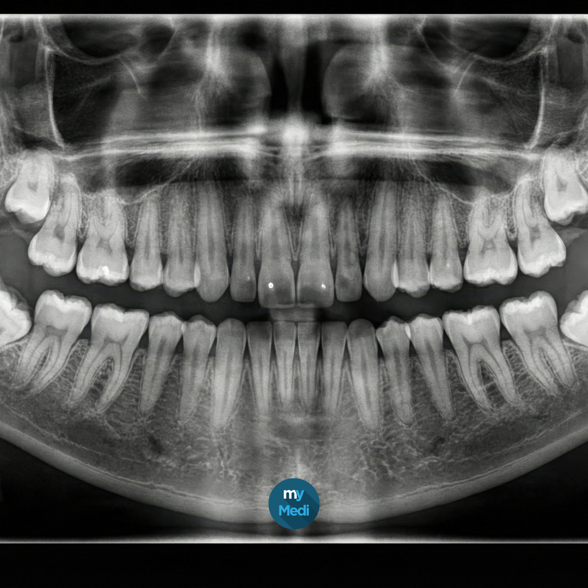 Radiologie numérique dentaire